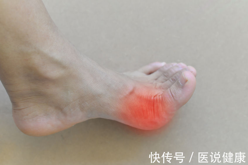 尿素高引起的痛风(尿素高患者，除了痛风，还会被这2种并发症困扰，需重视)