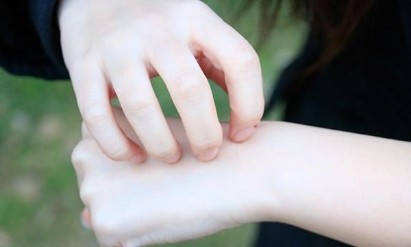  得了肝病|为什么肝病会引起皮肤瘙痒？肝病患者想要缓解瘙痒，需做什么？