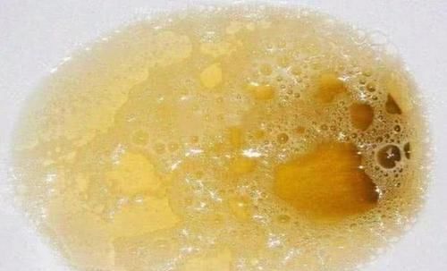 起床|“肝”不好的人，早上起床后可能会有“3个表现”，你中招了没