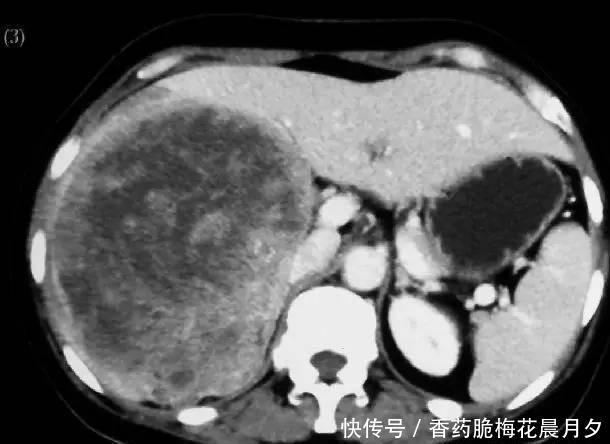 好不好|肝好不好,从什么地方能看出来