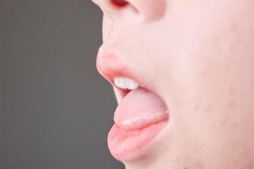  生病|舌头是身体晴雨表，哪些变化，说明你可能生病了？自测一下