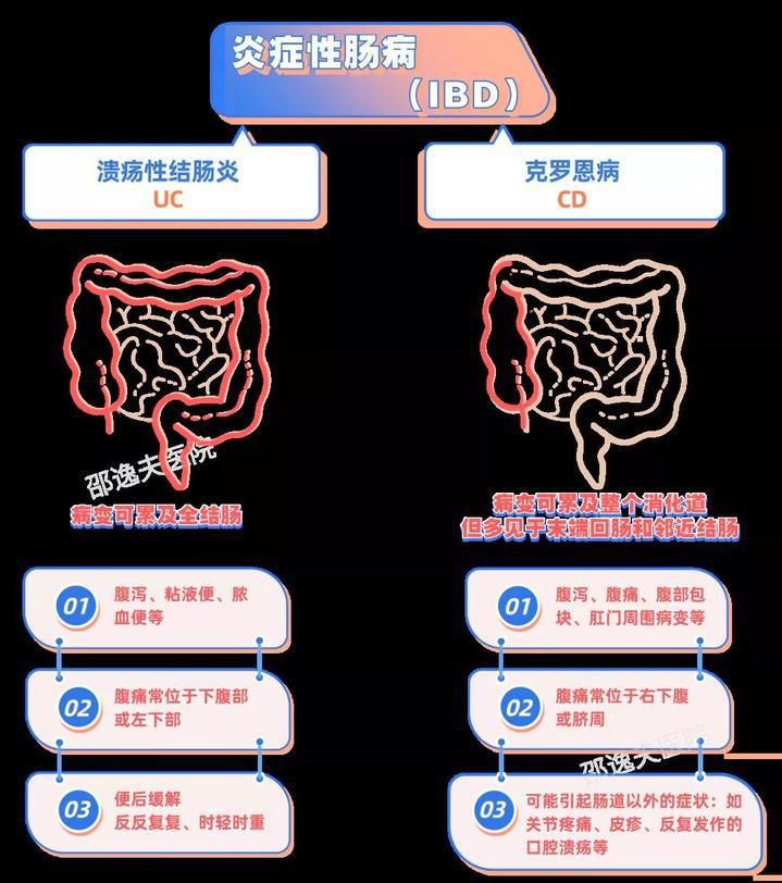 炎症性肠病|高考过后，十多位00后考生回这家医院继续接受治疗，他们都得了同一种病