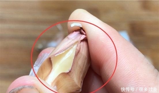 轻轻|原来大蒜身上有个“小机关”,轻轻一捏,蒜皮就能轻松脱落,实用
