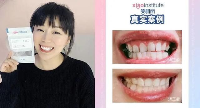  关注|《乘风破浪的姐姐》爆了 他们的牙齿又有谁关注到