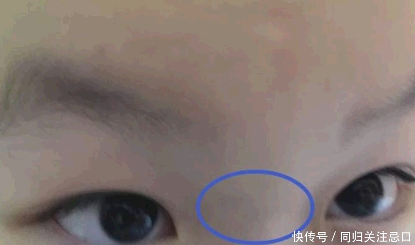 上有蓝色|老一辈说:孩子鼻梁有青筋,娃难养脾气差!从医学解释来看看