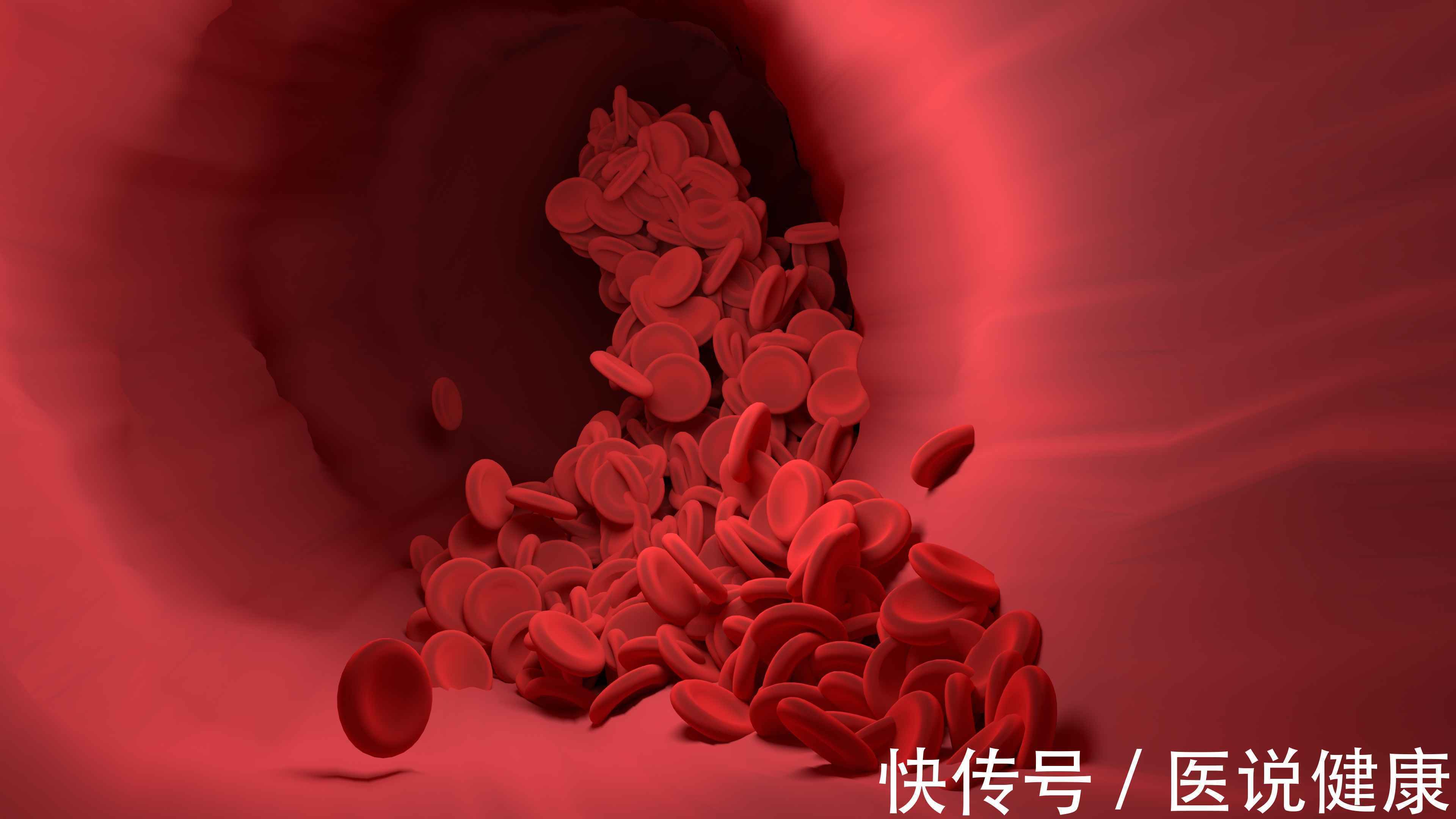 高血脂血管病人吃什么食物最好(不想高血脂找上门，饮食注意“少吃白、多吃红”，避免血管堵塞)