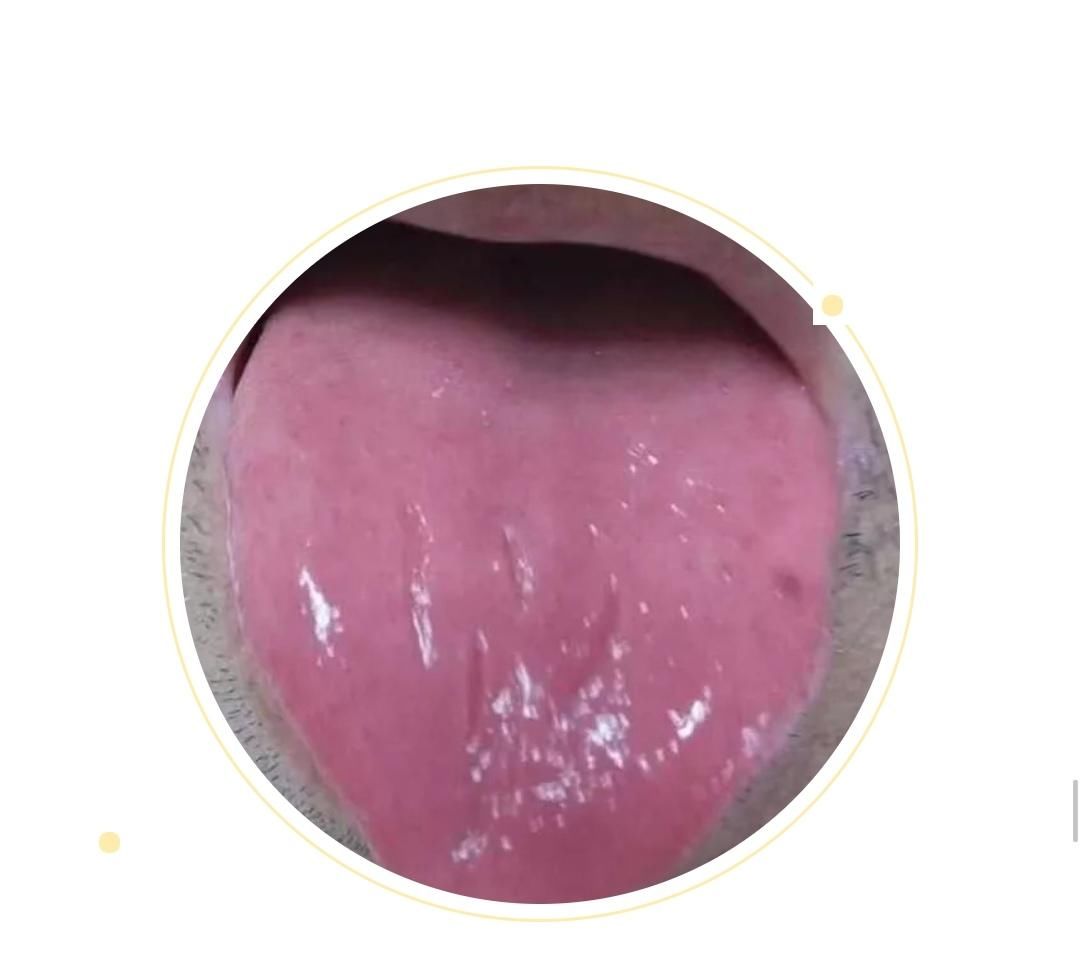  变化|身体健康情况怎么样？可以从舌头进行窥探