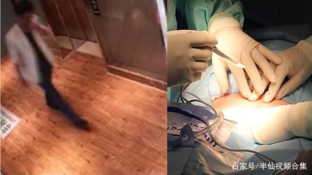 惨死|瞒着家人去隆胸惨死手术台!医生手术时离场2小时,内幕曝光!