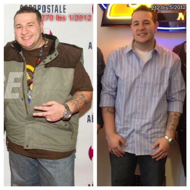  糖尿病|杨天真为什么要做切胃术？