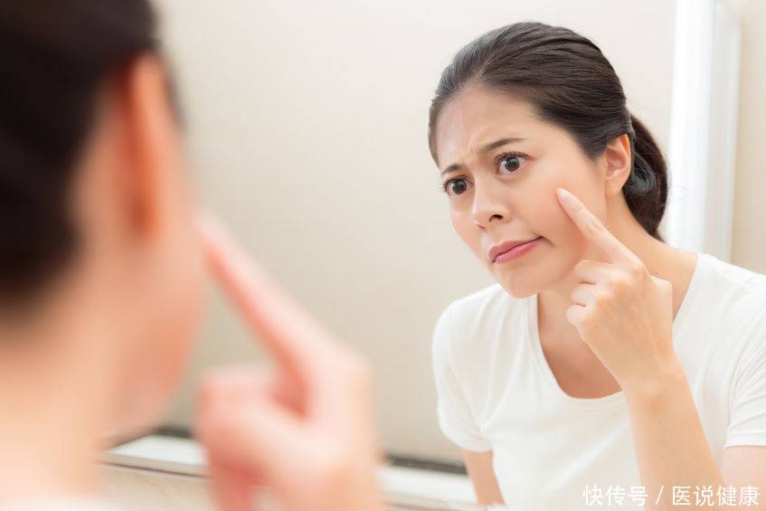 巧克力囊肿跟多囊卵巢有什么区别(巧克力囊肿和多囊卵巢综合症是同种疾病？医生：并不同，一文区分)