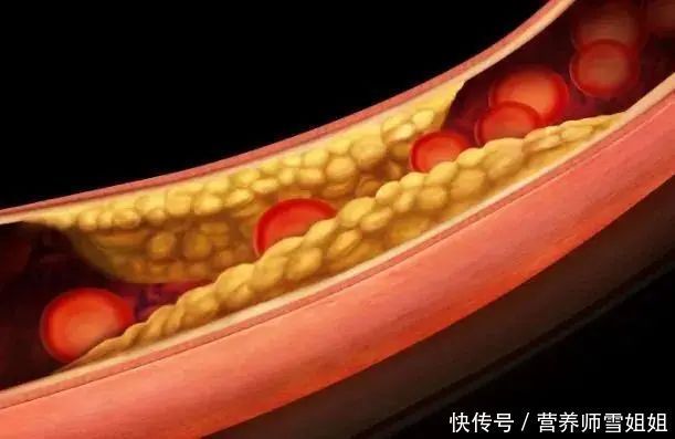  医生|28岁男子，拍婚纱照晕倒，医生查明原因后，准新娘说啥不嫁了