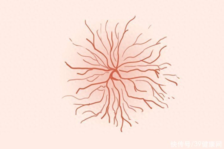 身上有红痣是肝病的前兆吗(身上长红痣，代表肝病来临？提醒：肝病变时，手脚可能有4种怪象)