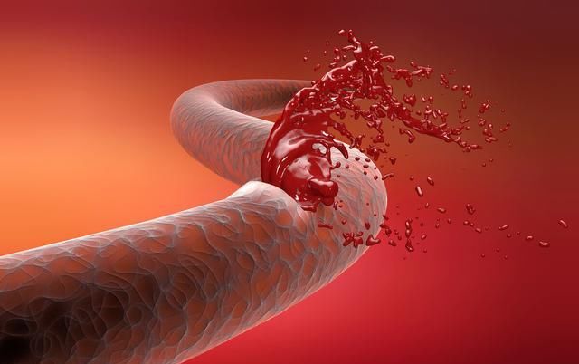 马桶|在冲完马桶之前看一眼，“大便”的异常提示早知道