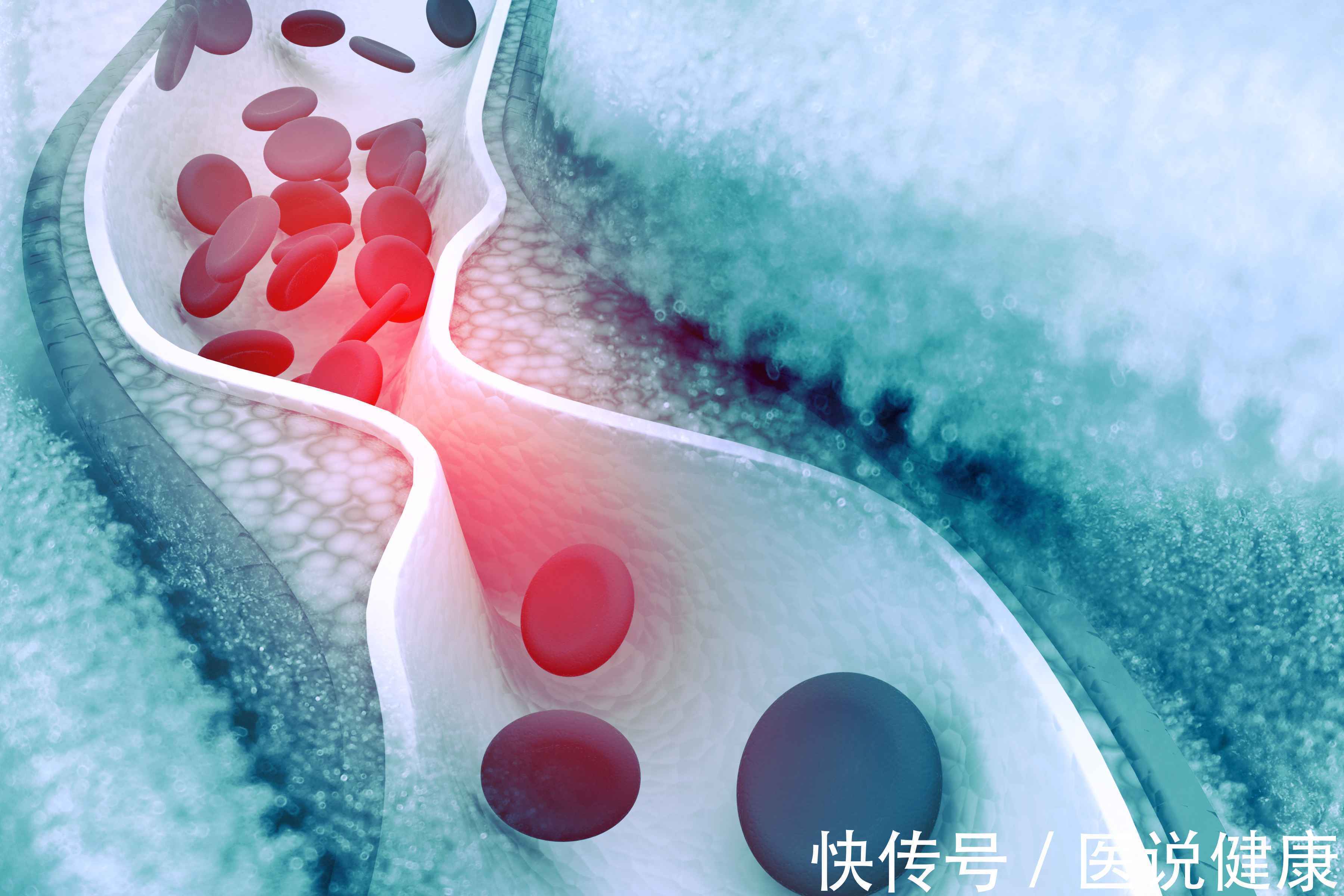 怎么预防脑梗的10个小妙招(想要预防脑梗，坚持做好3件事，或能远离脑梗的危害)